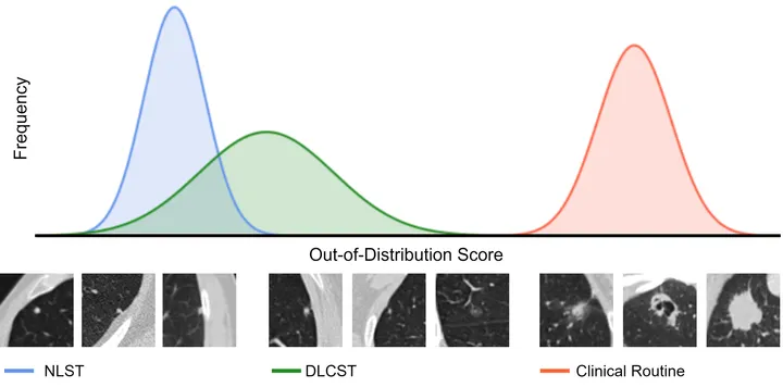 Out-of-distribution detection for chest CT