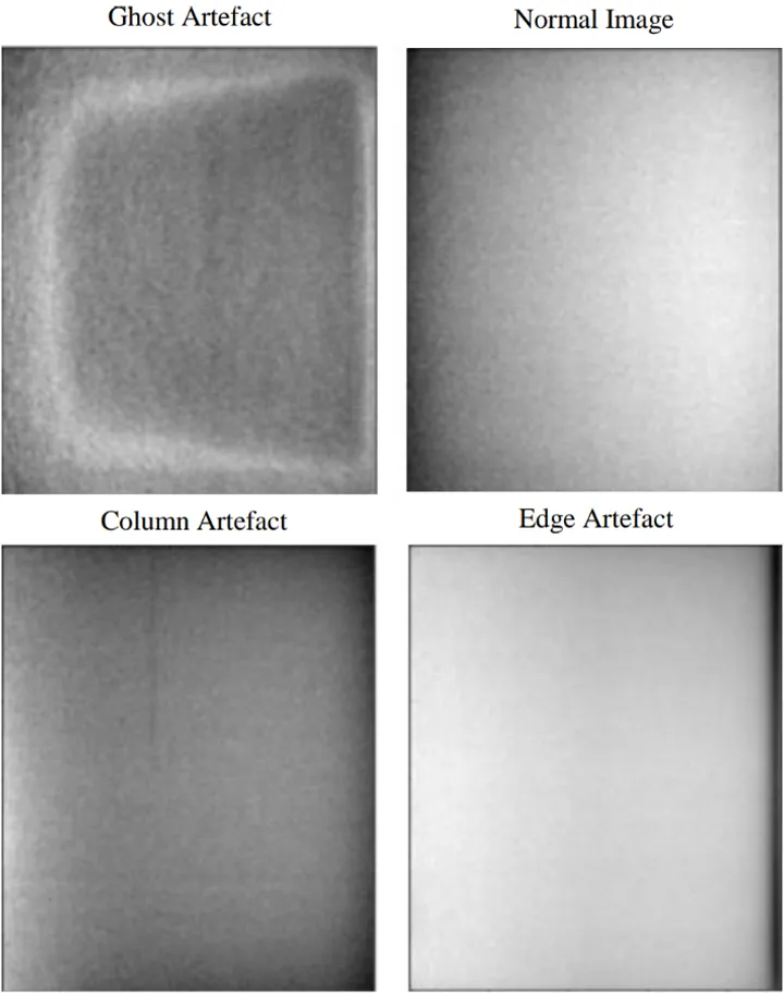 Examples of artefacts in X-ray phantom images